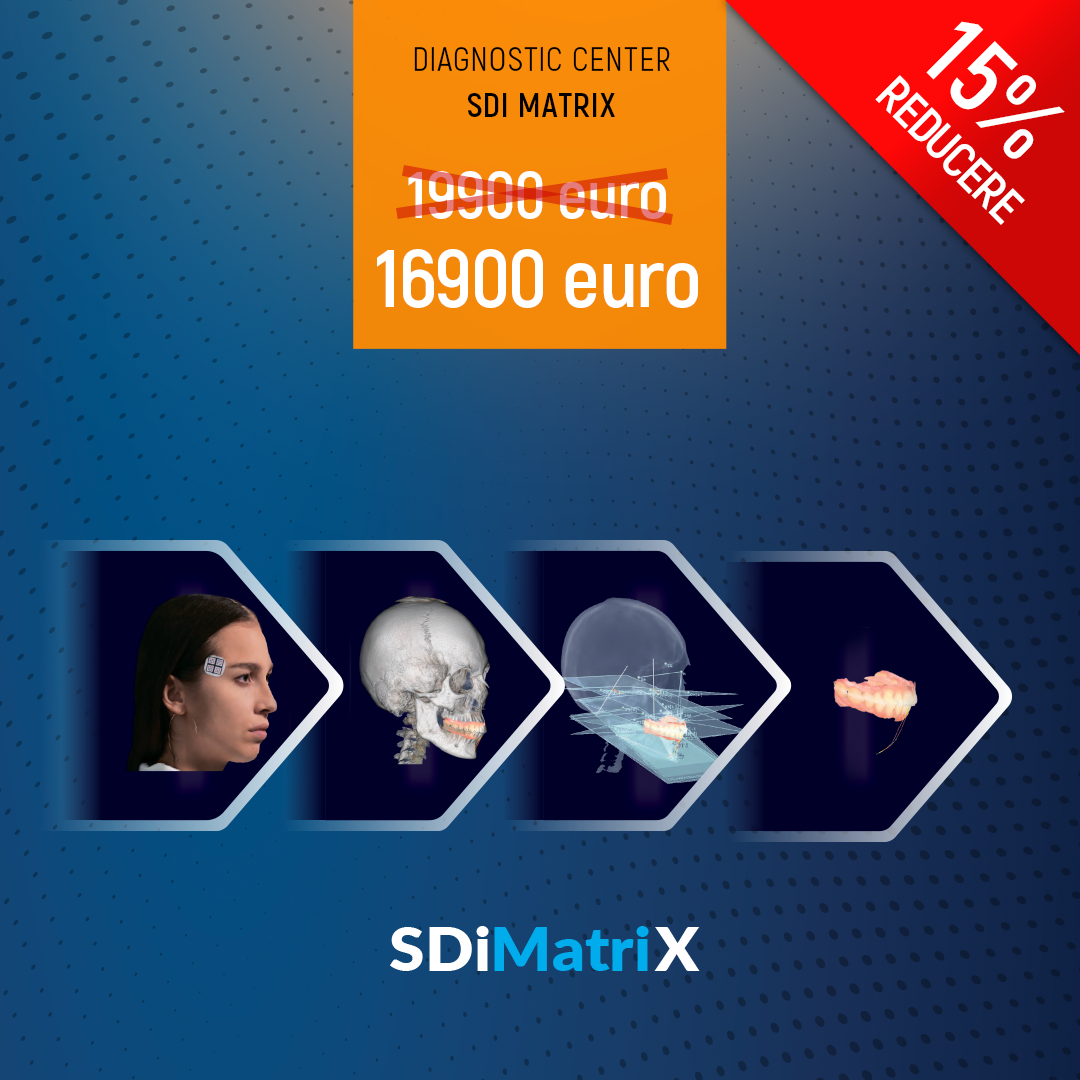 sdi