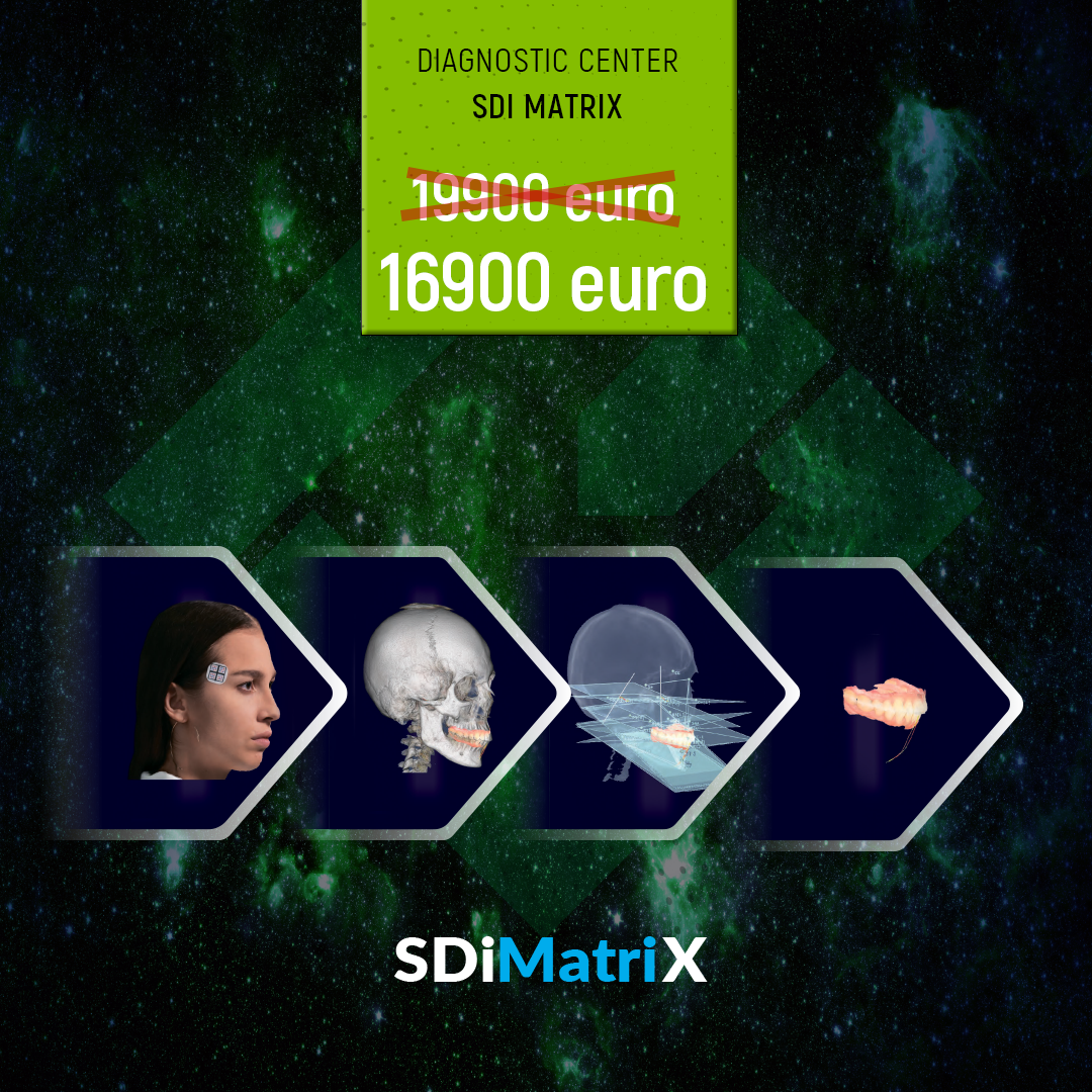 sdi