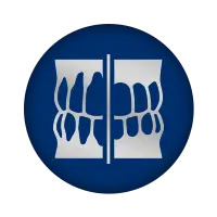 bone graft